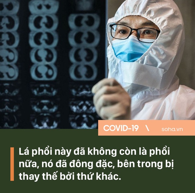 Hé lộ ca giải phẫu tử thi nhiễm Covid-19 đầu tiên trên thế giới: Giống như lính trinh sát, lại giống như phi hành gia - Ảnh 2.