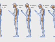 Chưa già mà đã hỏng cột sống là do 5 thói quen đang ngày càng phổ biến này Chưa già mà đã hỏng cột sống là do 5 thói quen đang ngày càng phổ biến này