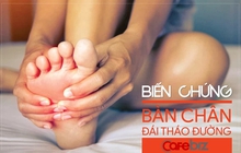 Cứ 30 giây trên thế giới lại có người bị cắt cụt chi vì biến chứng tiểu đường: Thấy chân có 1 trong 7 dấu hiệu QUEN THUỘC này phải đi khám ngay!