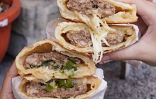 Trước khi phải chạy thận, những dấu hiệu này thường xuất hiện trước một năm, bác sĩ cảnh báo món nên tránh vào bữa sáng