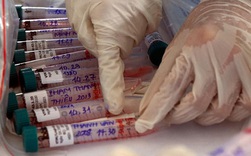 Chuyên gia cảnh báo: Test nhanh ÂM TÍNH không có nghĩa bạn hoàn toàn KHÔNG nhiễm SARS-COV-2