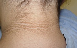 5 triệu chứng lạ và tưởng vô hại nhưng hóa ra lại là dấu hiệu báo bệnh nguy hiểm