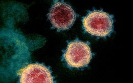 Nghiên cứu mới: Không chỉ phổi, virus SARS-CoV-2 còn có thể làm tổn thương não