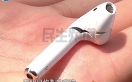 AirPods phát nổ trong khi đang gọi điện thoại khiến người dùng phải nhập viện