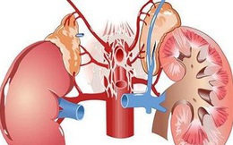 10 dấu hiệu cho thấy thận của bạn đang gặp vấn đề nghiêm trọng