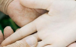 3 dấu hiệu bất thường ở bàn tay cho thấy dạ dày đang "kêu cứu", ở độ tuổi nào cũng cần làm ngay 4 việc để ngăn cản ung thư hình thành