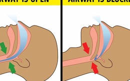 Cứ đến đúng giờ đó giữa đêm lại tỉnh giấc, nghe thì "kinh dị" nhưng hóa ra đều có lý do cả