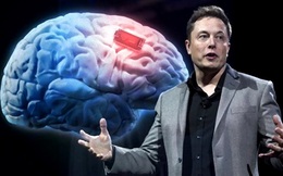 Tiết lộ cỗ máy cấy chip vào não người của Elon Musk