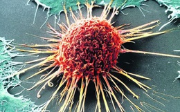 Sốc với các thủ thuật "tinh quái" của tế bào ung thư: Chuyển trạng thái dễ nuôi và giả vờ biến mất...