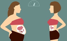 Nghiên cứu 100.000 người phát hiện: ung thư trực tràng đặc biệt thích tìm tới những người có "nguy cơ thể hình”