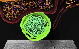 Công nghệ kính hiển vi này đã cho phép chúng ta nhìn thấy từng nguyên tử trong một tế bào