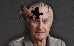 [QUIZZ] Alzheimer là căn bệnh "gánh nặng" ở người già: Ông bà bố mẹ bạn có đang gặp vấn đề với sinh hoạt hằng ngày không?