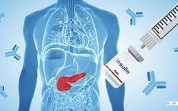 Ai bị ‘điểm danh’ vào hội những người mắc ‘bệnh nhà giàu’, nghèo sẽ càng nghèo: 4 hành động nhỏ kiểm soát nguy cơ mắc bệnh tiểu đường!