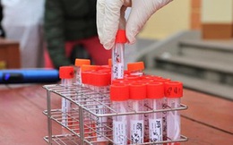 Phú Thọ phát hiện 2 ca dương tính SARS-CoV-2 liên quan "ổ dịch" Bệnh viện K và BV Nhiệt đới Trung ương