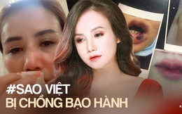Trước “cô Xuyến” Hoàng Yến, loạt sao Việt từng bị chồng bạo hành dã man: Dương Yến Ngọc chịu đánh 2-3 lần/ tuần, 1 Hoa hậu còn muốn tự tử