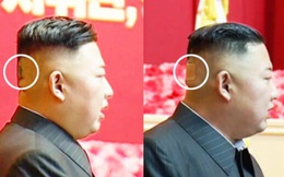 Băng dán đầu bí ẩn làm dấy lên những đồn đoán về sức khỏe ông Kim Jong Un