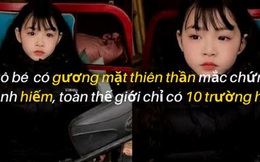 Xót lòng trước cô bé có gương mặt thiên thần mắc chứng bệnh hiếm, toàn thế giới chỉ có 10 trường hợp: 6 tuổi vẫn không thể nói chuyện, tự sinh hoạt, não thoái hóa dần thành người thực vật