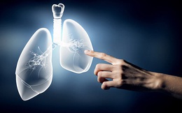 5 dấu hiệu cảnh báo lá phổi đang suy yếu: Có triệu chứng rất giống với Covid-19, đừng nhầm lẫn kẻo điều trị sai cách!