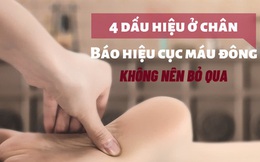 "Quả bom hẹn giờ" chôn trong huyết quản ít ai để ý tới: 4 dấu hiệu cho thấy cơ thể xuất hiện cục máu đông, nên biết càng sớm càng tốt!