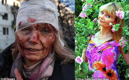 Người phụ nữ 'biểu tượng' về sự tàn phá ở Ukraine: Hình ảnh before - after gây khắc khoải
