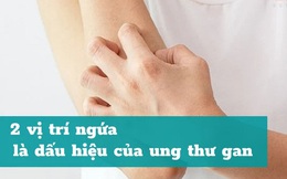 Ngứa ngáy ở 2 vùng này trên cơ thể rất có thể đó là dấu hiệu “sát thủ” ung thư gan