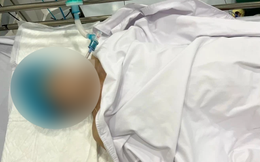 KHẨN: Bộ Y tế vào cuộc vụ người phụ nữ tử vong khi nâng ngực tại TP.HCM