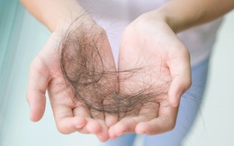 Tóc rụng thường xuyên không rõ nguyên nhân, khi nào sẽ trở thành bệnh?