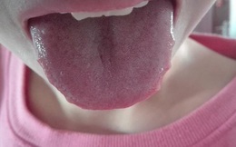 3 hiện tượng bất thường ở vùng răng miệng có thể giúp bạn phán đoán sớm nguy cơ mắc bệnh ung thư gan