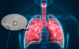 Phần mới của cơ thể được tìm thấy ẩn trong phổi