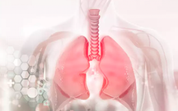 Các triệu chứng ban đầu của bệnh ung thư phổi cần đề phòng