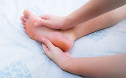 Muốn biết gan tốt hay không chỉ cần nhìn vào bàn chân: Có 6 dấu hiệu này chứng tỏ gan đang bị bệnh