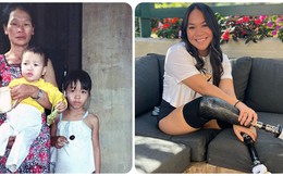 Cuộc sống hiện tại của bé gái gốc Việt bị bố mẹ nổ bom mất 2 chân: Được báo chí thế giới gọi là 'nữ kình ngư thần kỳ', trở thành đại sứ truyền cảm hứng cho những người khuyết tật