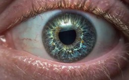 Dấu hiệu ở mắt cảnh báo ung thư dạ dày