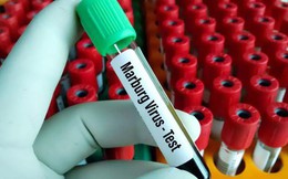 Bộ Y tế yêu cầu giám sát dịch Marburg có khả năng tử vong lên tới 88%: Nắm rõ ngay con đường lây truyền và dấu hiệu mắc bệnh để phòng ngừa