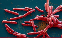 Phát hiện ca đầu tiên nhiễm vi khuẩn 'ăn thịt người' Whitmore ở Đắk Nông