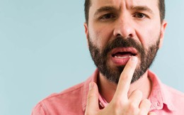 1 dấu hiệu ở miệng có thể cảnh báo 5 bệnh nghiêm trọng