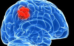 Người phụ nữ phát hiện u não từ dấu hiệu bất thường khi ngủ dậy