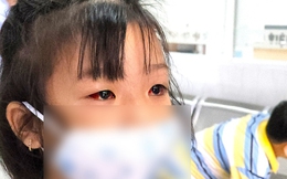 Bệnh viện Nhi đồng 2: Hàng chục ca đau mắt đỏ đến khám mỗi ngày