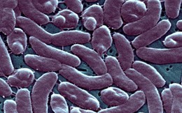 CDC Mỹ cảnh báo sức khỏe sau khi 5 người chết vì 'vi khuẩn ăn thịt người'