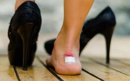 Tập gym theo video trên mạng, người phụ nữ "xém" thoát vị đĩa đệm