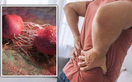 Ngày càng nhiều nam giới mắc ung thư tuyến tiền liệt: Thấy những dấu hiệu này thì làm ơn đừng bỏ qua