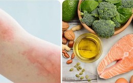 Dấu hiệu thiếu Omega-3 nhà cái uy tín cacuoc không nên chủ quan