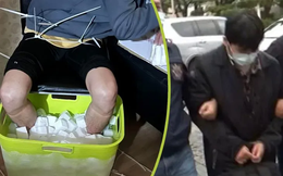 Ngâm chân trong đá lạnh 10 tiếng để lừa bảo hiểm, nam sinh viên bị cắt cụt cả hai bàn chân