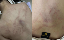 Nóng: Bé gái 4 tuổi bị cô giáo mầm non công lập ở Hà Nội bạo hành dã man, trích xuất camera phát hiện hành động gây sốc