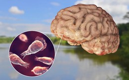 Phát hiện ‘amip ăn não’ trong nguồn nước sinh hoạt tại quốc gia có cộng đồng người Việt đông thứ 3 thế giới