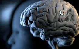 Stanford công bố nghiên cứu gây sốc: Chip não đọc được ý nghĩ chính xác tới 74% - Bước tiến khoa hay cơn ác mộng quyền riêng tư?