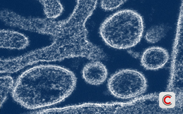 Nipah 2026: "Sát thủ" có tỷ lệ tử vong 40-75%, chưa có vaccine đặc hiệu