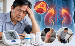 Vì sao uống 3-4 loại thuốc huyết áp mỗi ngày nhưng chỉ số vẫn cao?