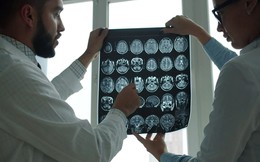 Biến đổi khí hậu làm tăng nguy cơ đau đầu, mất trí nhớ