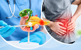 Khám cho nhiều người mắc ung thư tuyến tụy giai đoạn cuối, bác sĩ tiếc nuối: Dấu hiệu xuất hiện sớm nhưng hay bị bỏ qua